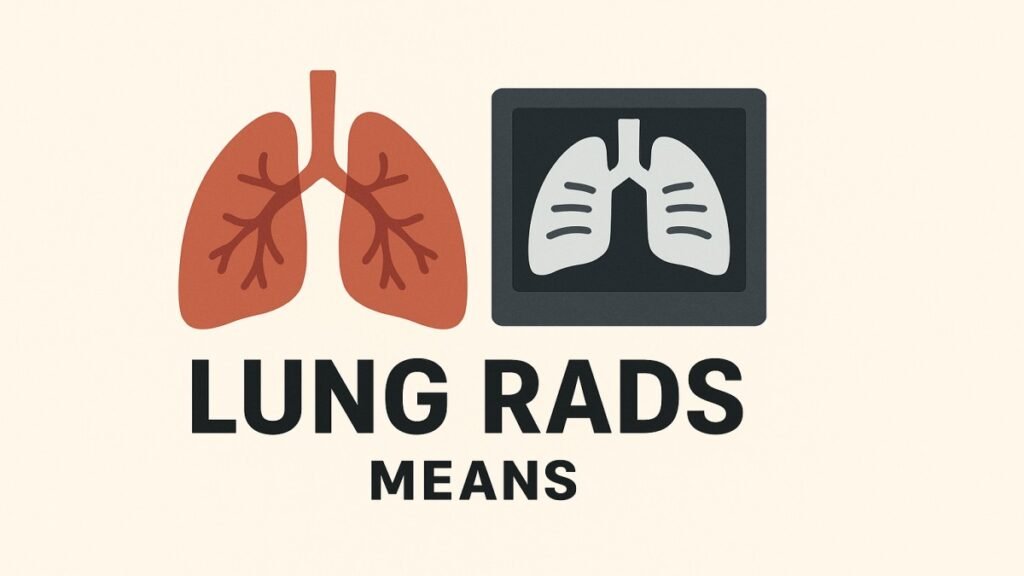 Lung-RADS