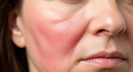 Unlocking the Secrets of Cellulogia: The Ultimate Guide to Smooth, Radiant Skin Cellulogia skin